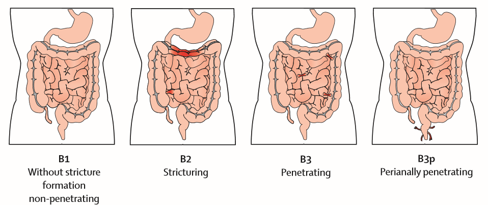 2020-04-29 01-55-16 Microsoft Edge-min.png